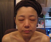 なんと!1回だけの施術です